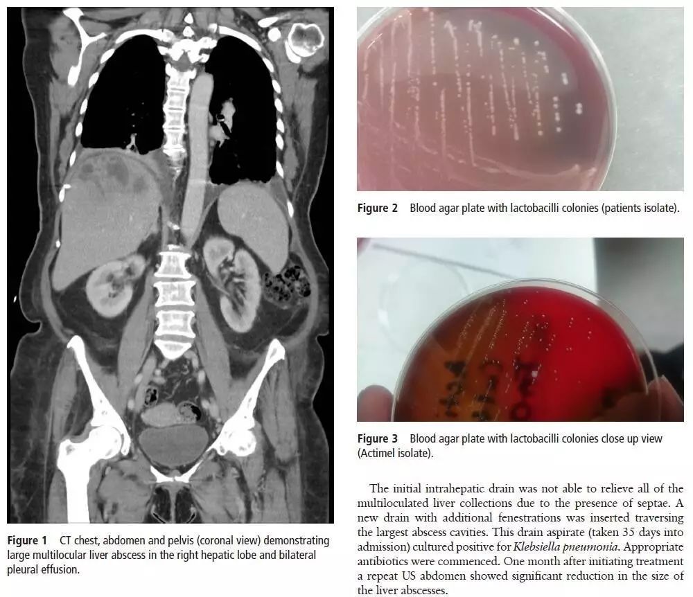1507794990586593.jpg 微信圖片_20171012155738.jpg